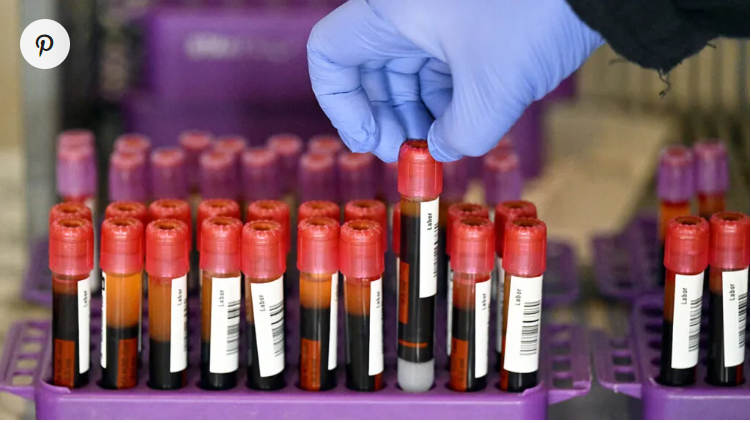 Blood tests for Alzheimer's may identify "toxic" proteins years before symptoms appear